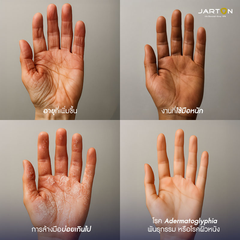Web-CT-thin-fingerprint